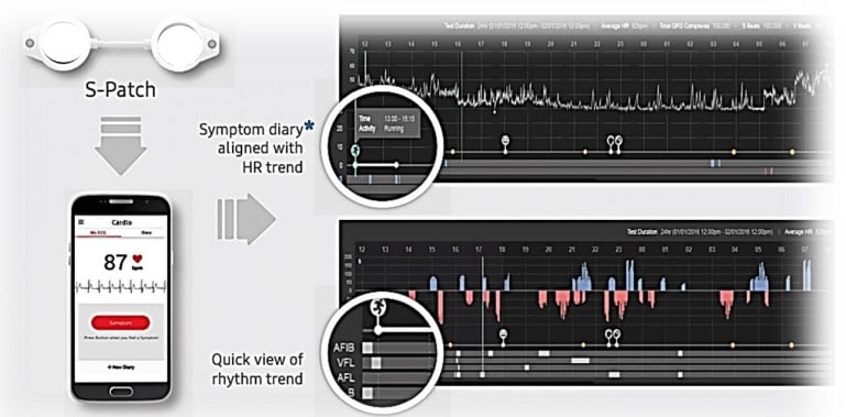 Modern Heart Rate Recording System