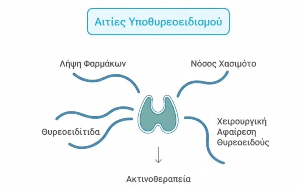 Causes of hypothyroidism