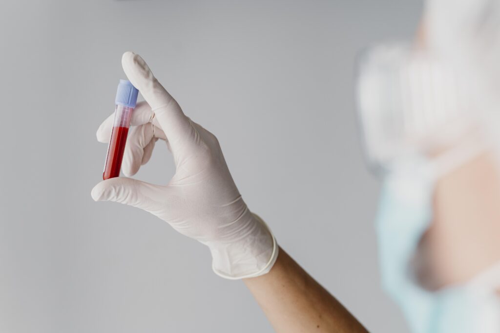 Doctor holding a blood sample