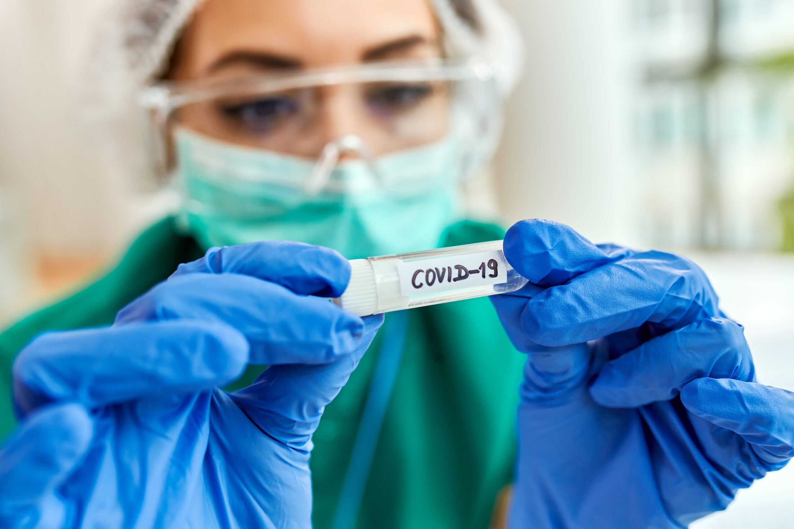 Doctor holding a COVID-19 sample tube