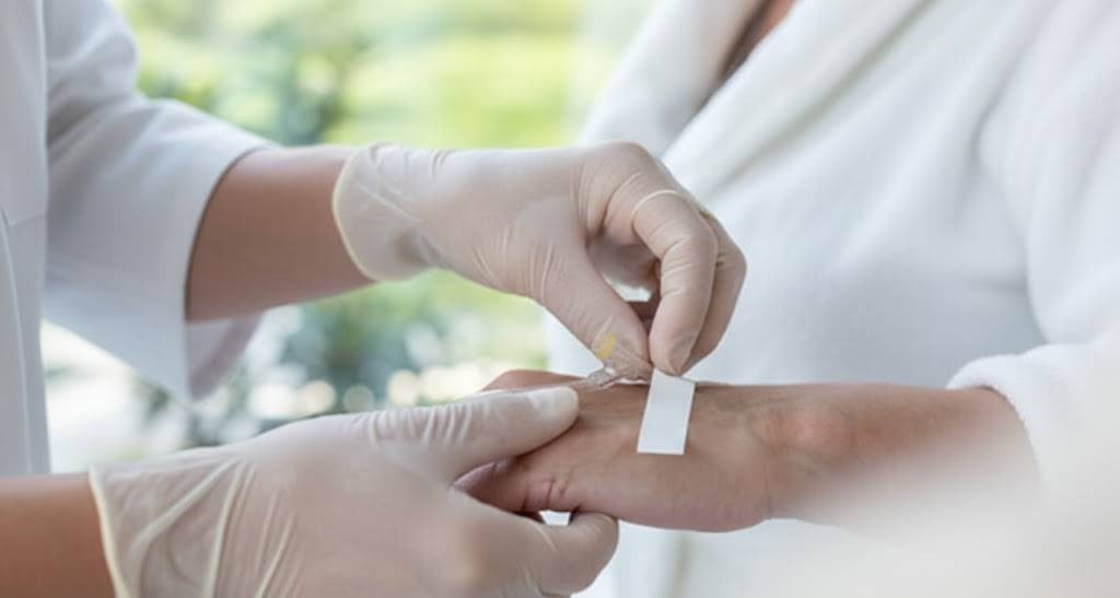 Doctor placing a cather on patient's hand