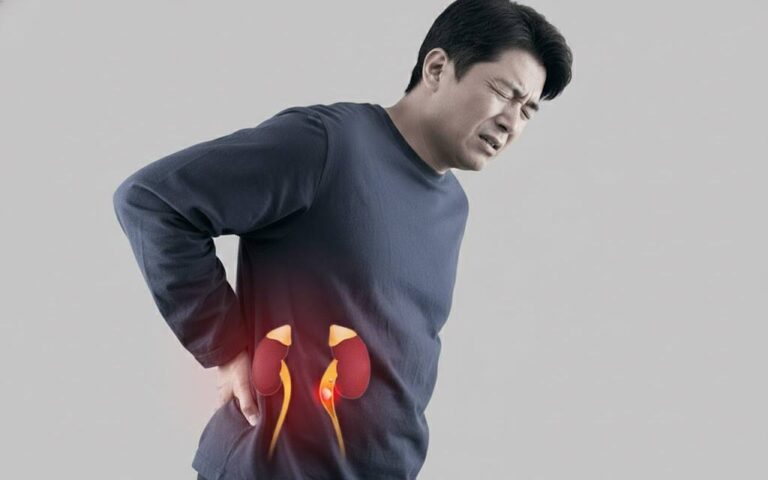 Πέτρα στα Νεφρά